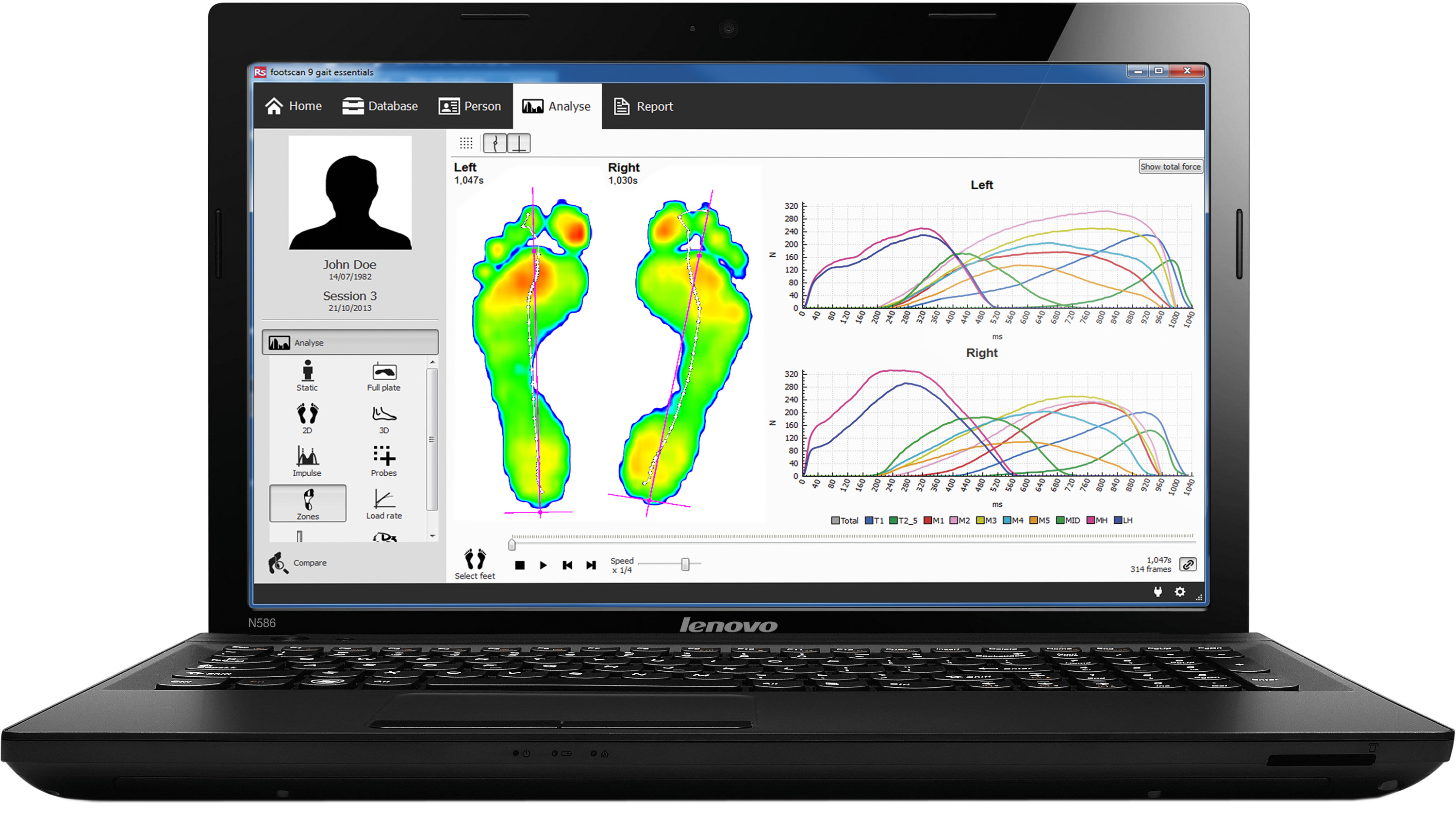 tl_files/sportivation/content/Newsletter/Footscan mit SPORTIVATION.jpg